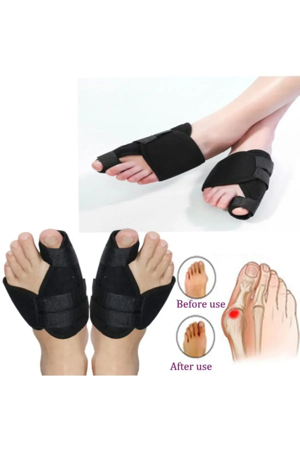Ноќна шина за Hallux Valgus, корективен третман за испакната коска на палецот, заштитник за бунион
