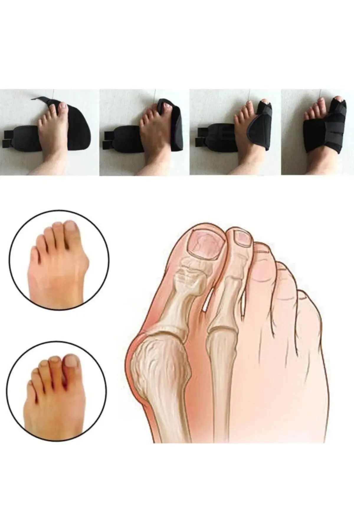 Ноќна шина за Hallux Valgus, корективен третман за испакната коска на палецот, заштитник за бунион